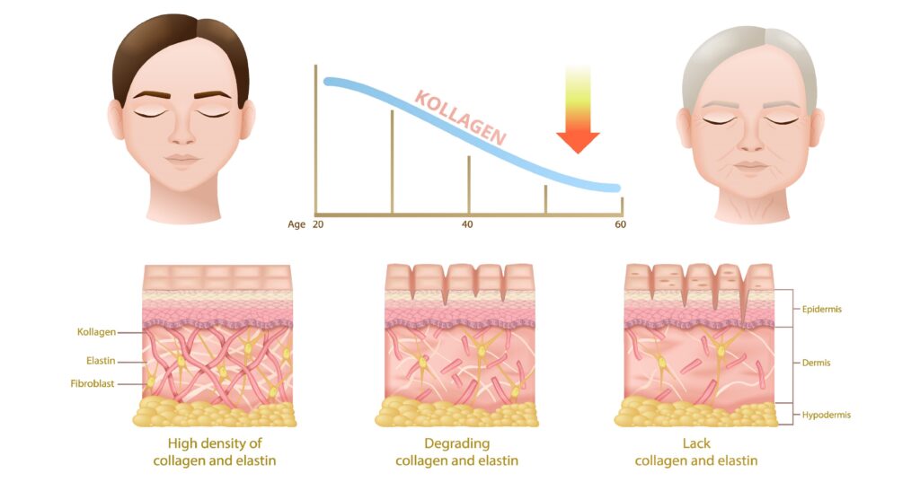 collagen-production-scaled